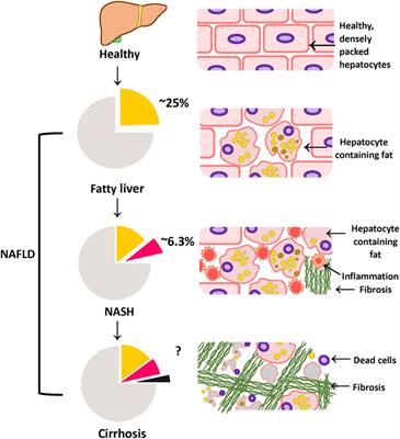 Non-Alcoholic Steatohepatitis: A Review of Its Mechanism, Models and Medical Treatments